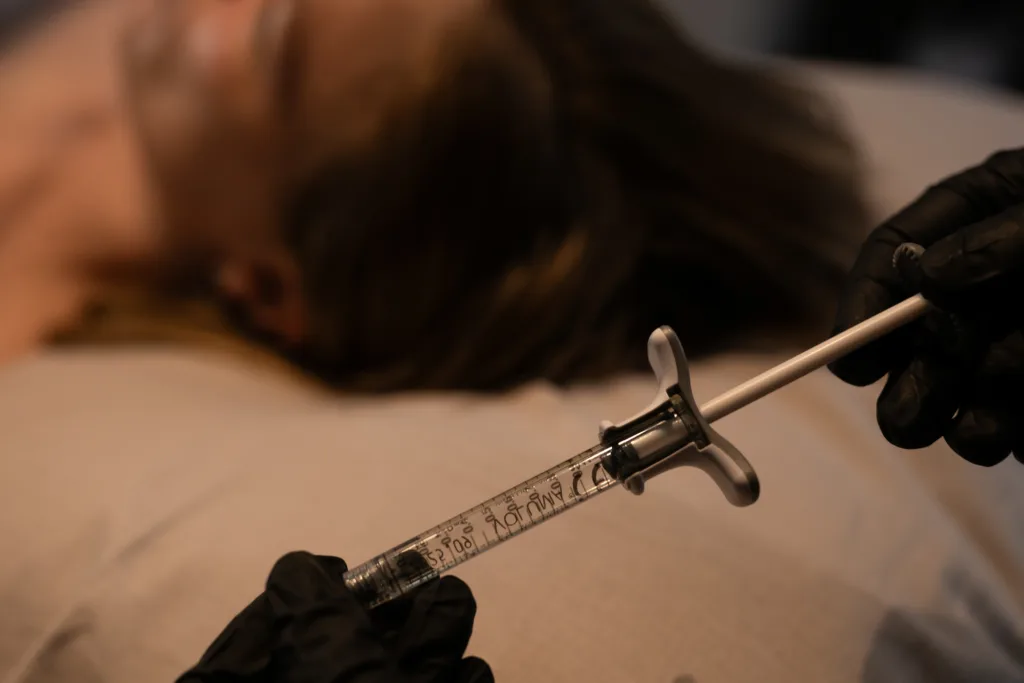 Juvederm täyteaineet, johtava täyteainemerkki, Laadukas ja korkeatasoinen. Allergan. Keskikasvot, leuka, leukalinja ja huulet.