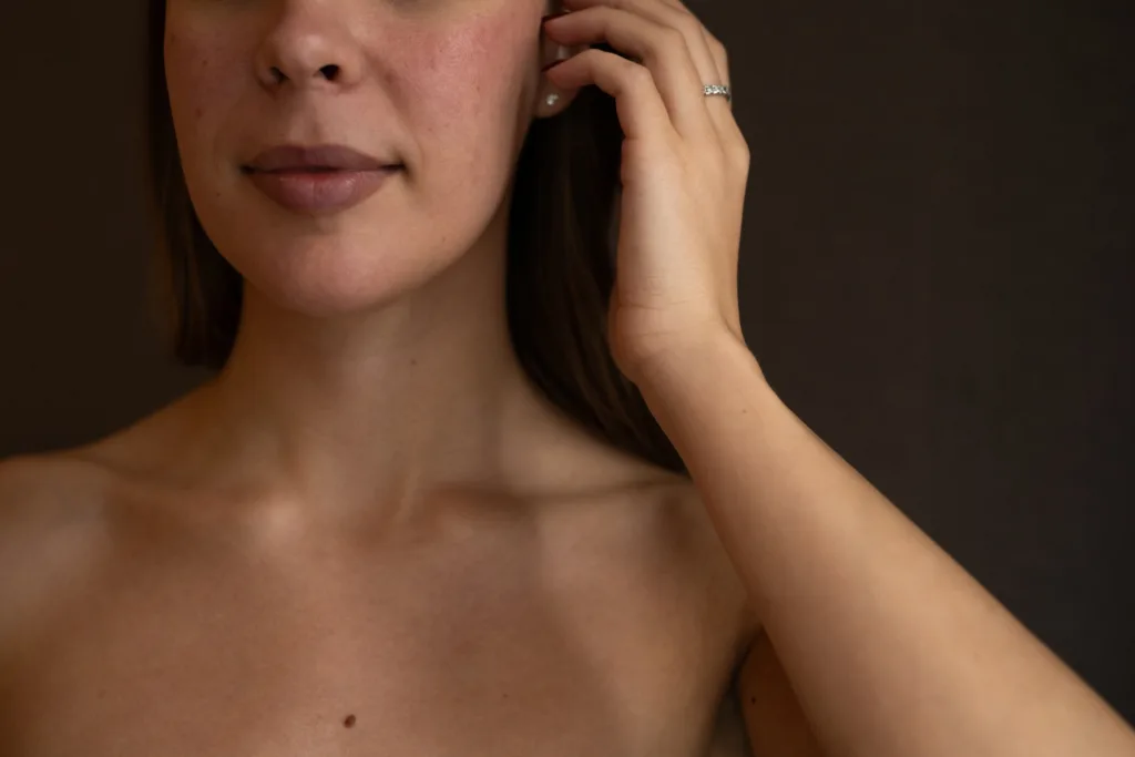 Hoida herkkää ihoa hellästi. Herkkää ihoa voi hoitaa LED valohoidoilla, kosteuttavilla ihonhoidoilla kuten mesoterapiaa.